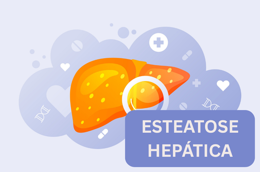 Fígado Gorduroso, Esteatose Hepática