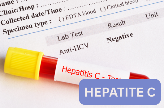 Hepatite C